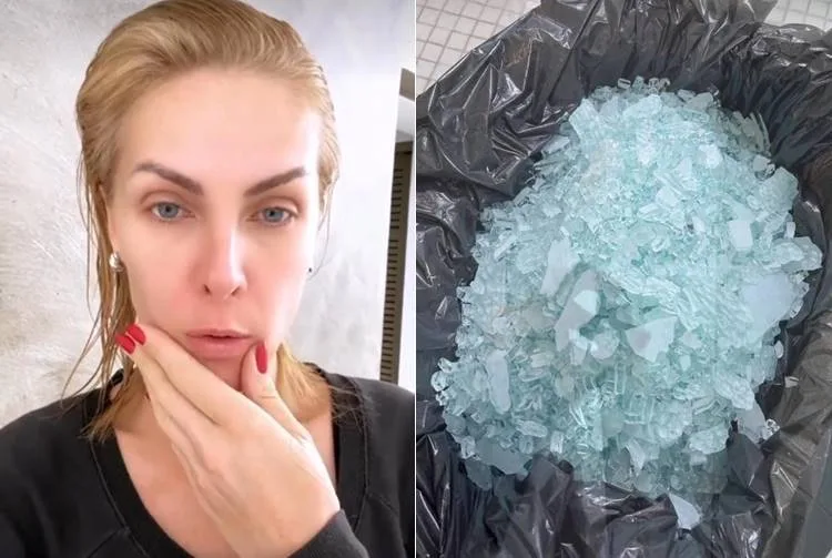 Ana Hickmann sofre acidente e impressiona: ”Preocupada”