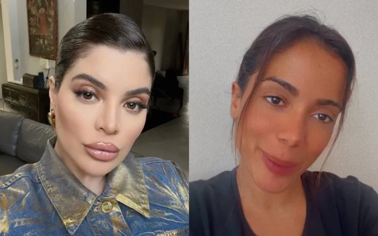 Gkay se pronuncia após Anitta atualizar estado de saúde: “se cuida por favor”