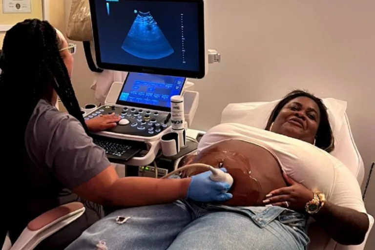 Jojo Todynho faz ultrassom após anúncio sobre gravidez e começa a montar o enxoval