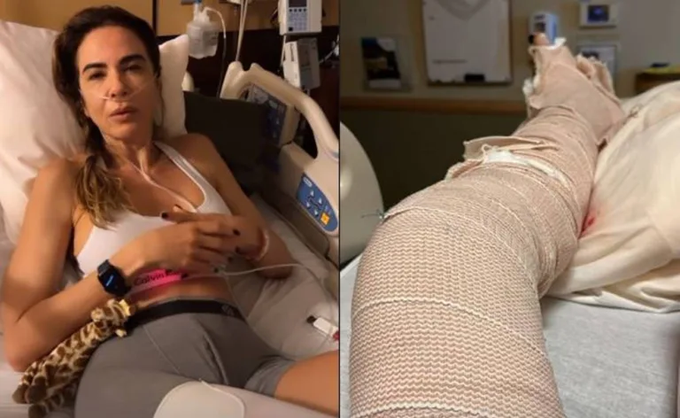 Após grave acidente, Luciana Gimenez relembra amor pelos filhos: ”Me deu forças”