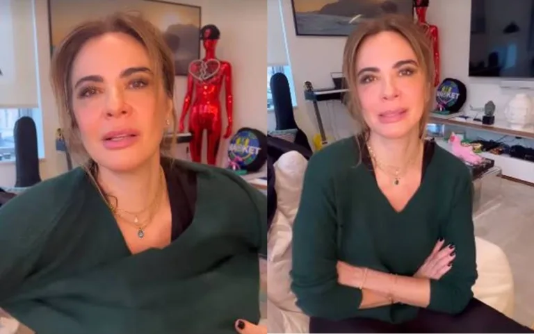 Luciana Gimenez choca ao mostrar hematomas na perna: “Isso tá doendo”