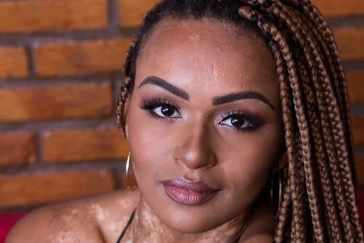 Natália Deodato faz desabafo sobre agressão de ex-namorado: ‘Como deixei isso acontecer?’