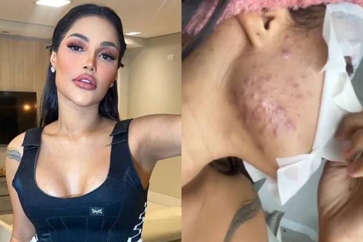 Flay mostra reação ao chip da beleza e alerta os fãs: “não caiam na mesma cilada”