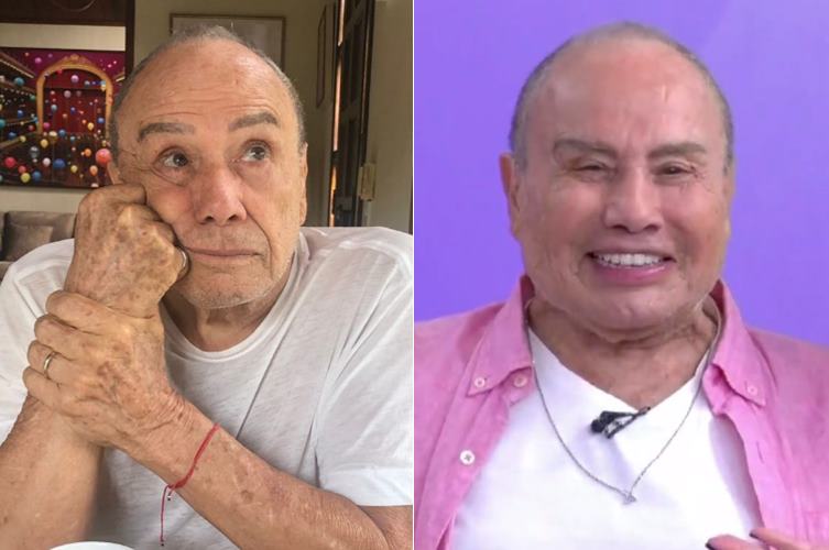 Stênio Garcia rebate críticas após harmonização facial: ”fiz para voltar para o mercado”