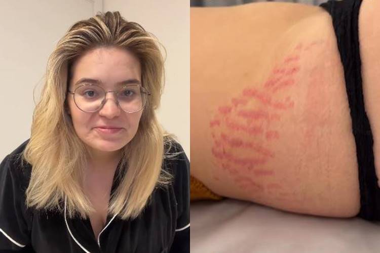 Viih Tube expõe tratamento para estrias após gravidez de Lua