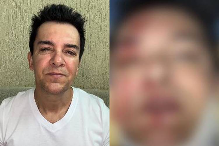 Regis Danese sofre grave acidente e surge sangrando: “Orem por mim”