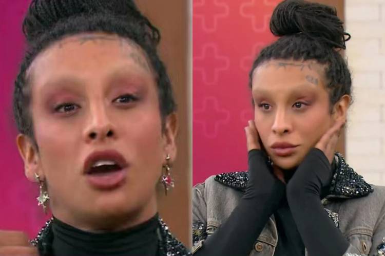 Ex-BBB Linn da Quebrada desabafa sobre sequelas de cirurgia de feminização: ‘Parecia um sapo-boi’