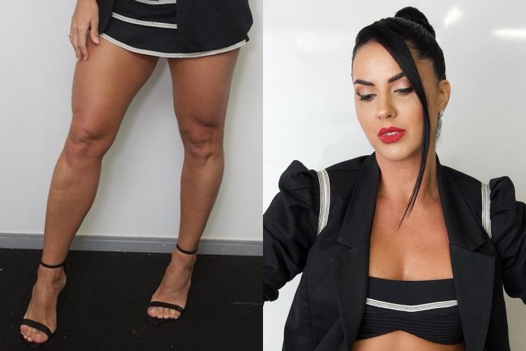 Graciele Lacerda é alvo de críticas após surgir com vestido curtíssimo: ‘não acho elegante para mulher madura’