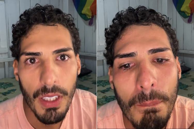 Agenor, da capivara Filó, se pronuncia após polêmica envolvendo a família