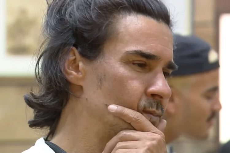 André Gonçalves realiza harmonização facial e resultado é revelado