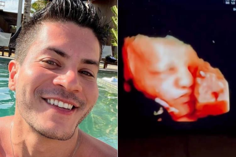 Arthur Aguiar mostra ultrassom com o rosto do filho e emociona: ”Nosso príncipe”