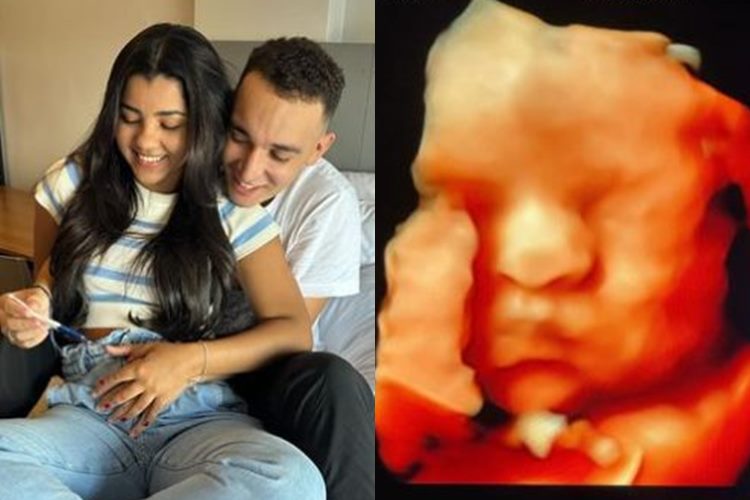 Ary Mirelle encanta ao mostrar o rostinho de seu filho com João Gomes