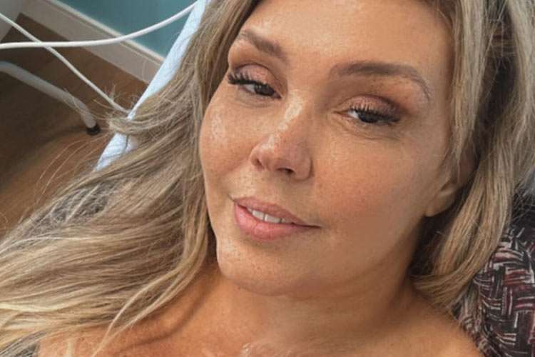 Simony faz desabafo após receber ataques por mudança no rosto em tratamento e desabafa: ‘Estou viva, grata e feliz’