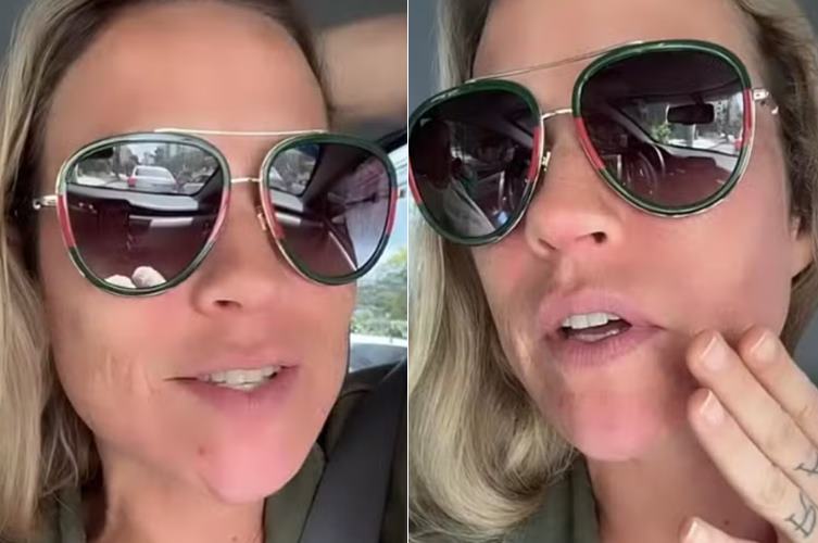 Após alta hospitalar, Luana Piovani faz procedimento estético no rosto: ”Maravilha”