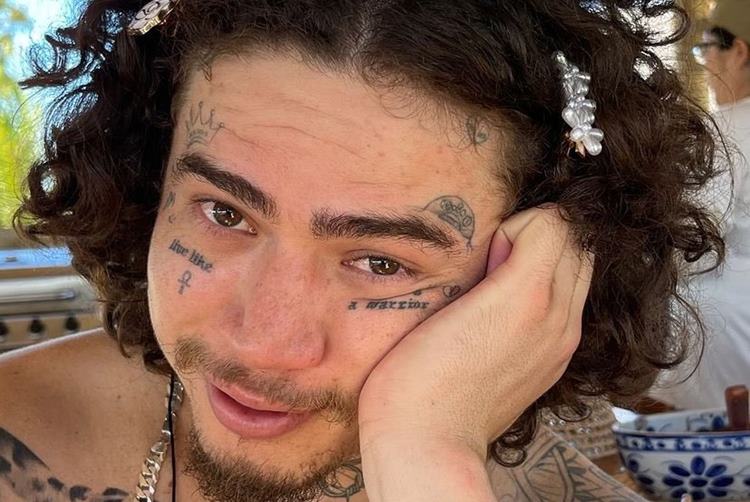 Whindersson Nunes mostra antes e depois e surpreende: ”Trocaria de calçada”