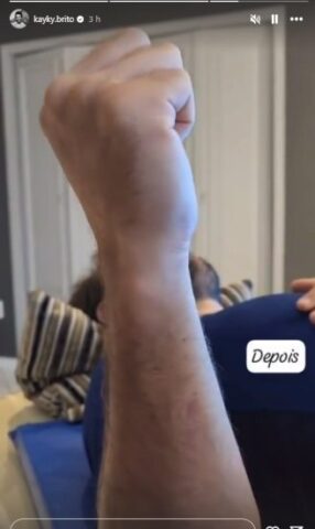 Kayky Brito 3 O stories de Kayky sobre o assunto (Reprodução: Instagram)