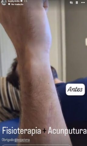Kayky Brito O stories de Kayky sobre o assunto (Reprodução: Instagram)