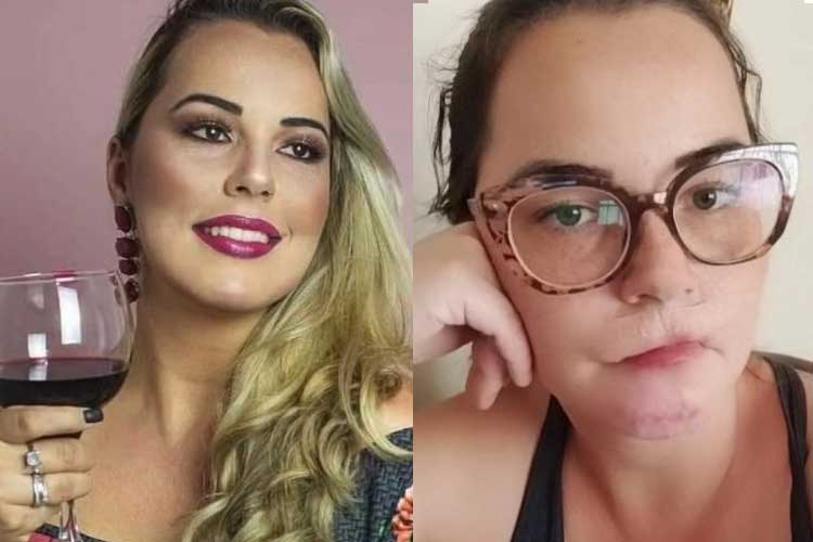 Influenciadora perde os lábios após harmonização facial e faz alerta: ‘Foi na confiança’