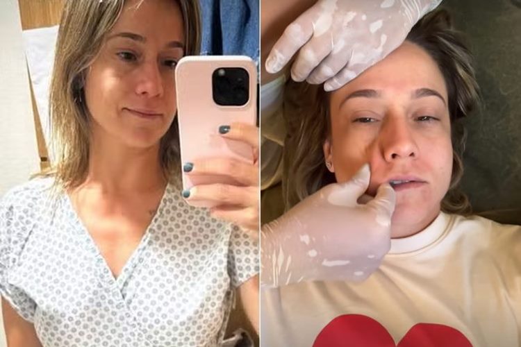 Fernanda Gentil exibe tratamento para conter avanço de paralisia