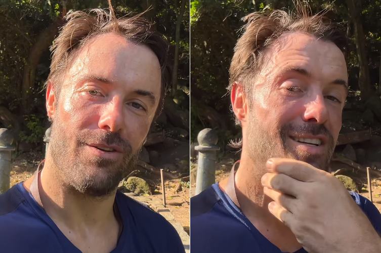 Kayky Brito comenta sobre recuperação após grave acidente: ”Dois parafusos gigantes”