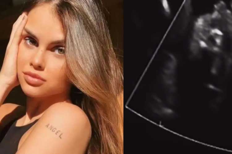 Suposta mãe do terceiro filho de Neymar mostra o rosto do bebê no ultrassom