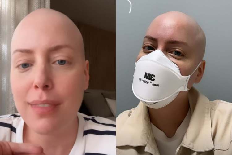 Fabiana Justus faz relato importante após transplante de medula óssea