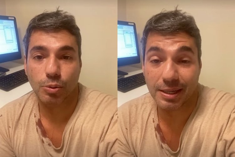 Felipe Bronze é agredido durante assalto no Rio de Janeiro: “fui rendido”