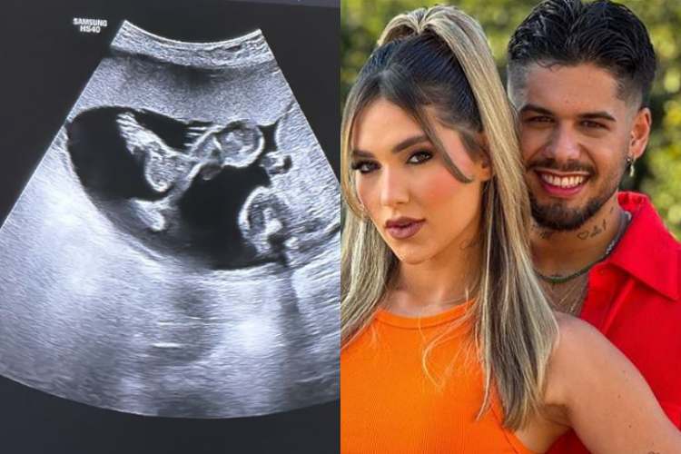 Virginia Fonseca compartilha reação de Zé Felipe durante ultrassom de José Leonardo: “Papai babando”