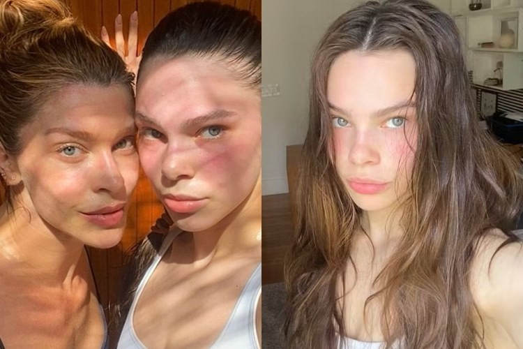 Grazi Massafera posa com a sobrinha e semelhança entre elas impressiona: “xerox”