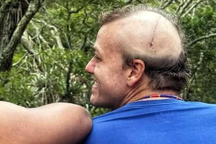 Ator de ‘Garota do Momento’ grava pela primeira vez após deixar o elenco devido a uma cirurgia na cabeça: ‘Mais um ciclo’