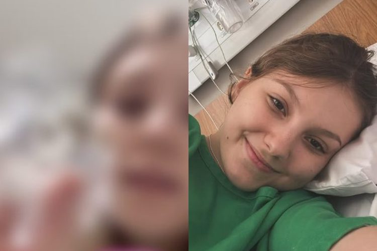 Isabel Veloso exibe dezenas de pedras que tirou da vesícula