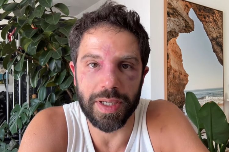 Duda Nagle surge ‘desfigurado’ e desabafa após perder luta de boxe para Popó