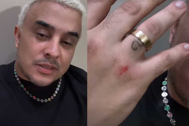 Kauan, da dupla com Matheus, leva tombo e se machuca durante show em Pernambuco
