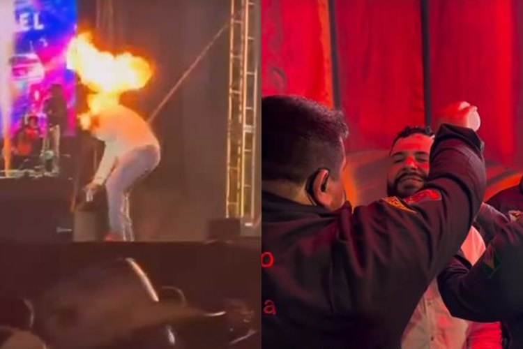 Sertanejo Léo sofre queimaduras no rosto durante show