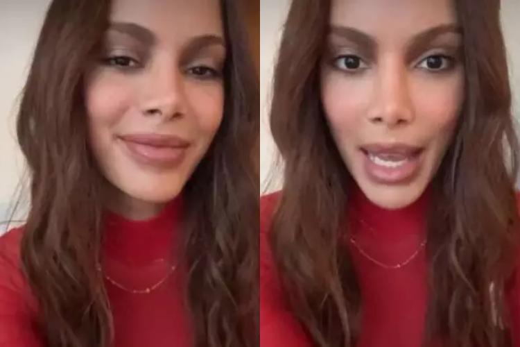 Anitta rompe silêncio sobre novo procedimento no rosto