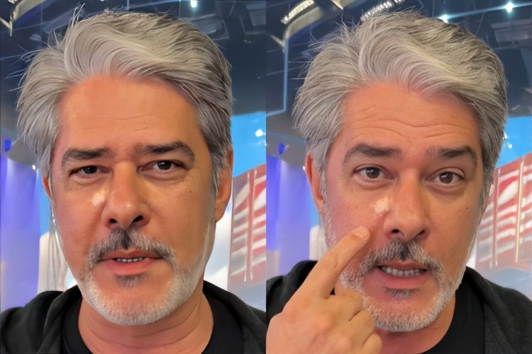 William Bonner aparece com curativo no rosto e explica motivo: “Antes que você estranhe”