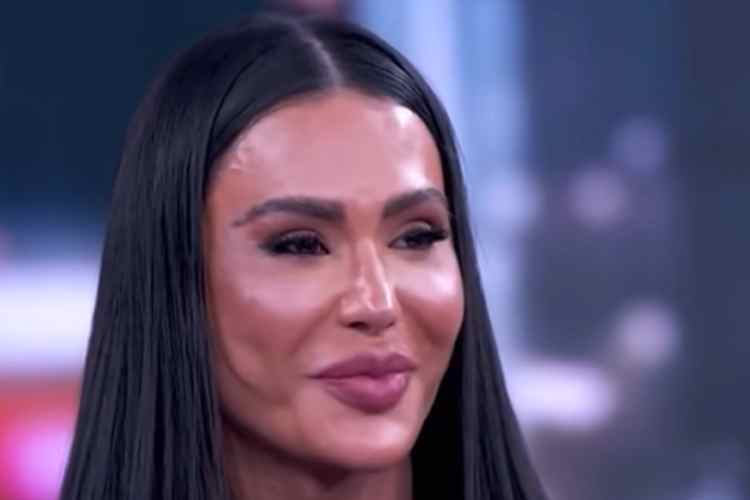 Gracyanne Barbosa sofre acidente nos bastidores da ‘Dança dos Famosos’ e detalhes vem à tona