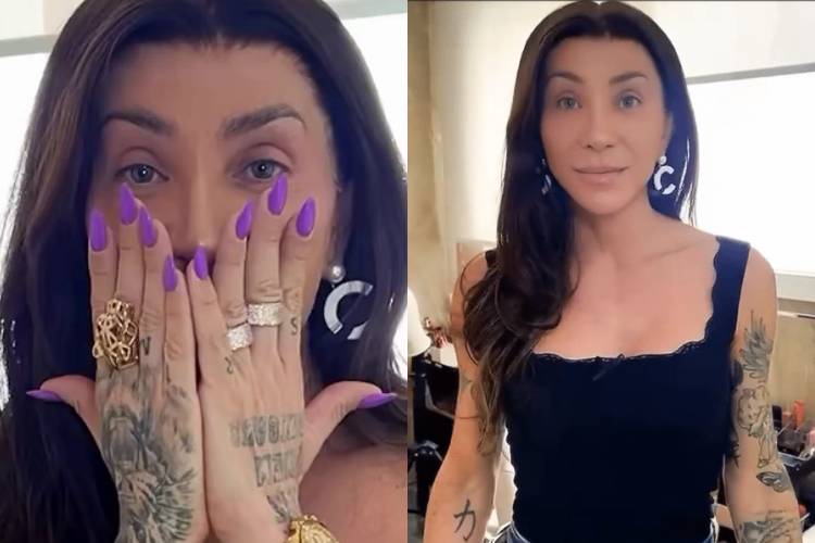 Maya Massafera desabafa após perder parte do maxilar e cirurgias e mostra como está