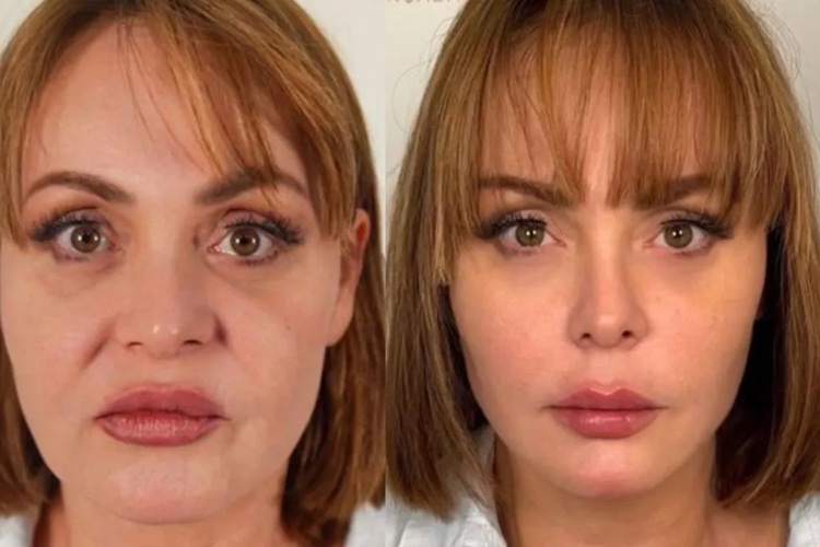 Antes e depois de Gaby Spanic (Foto: Reprodução)