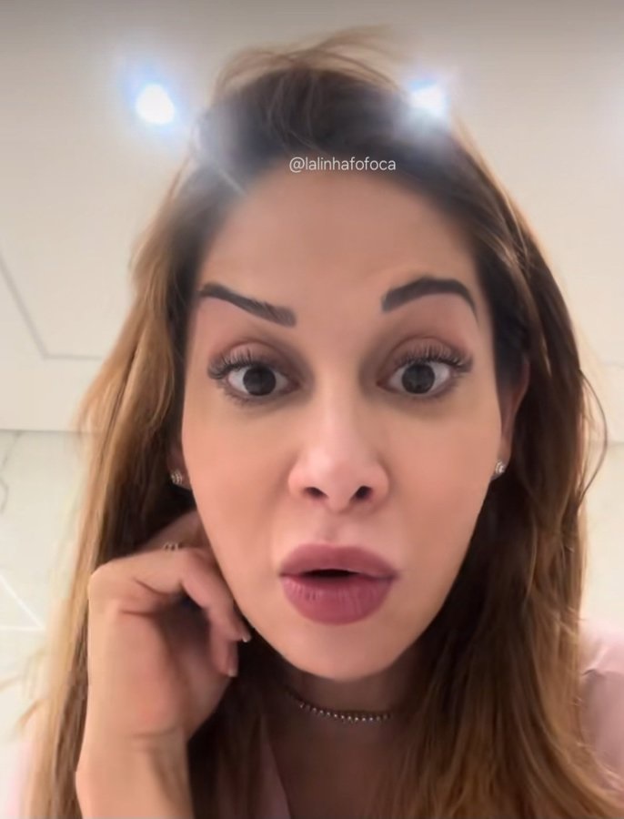Botox de Maira Cardi dá o que falar na web (Foto: Reprodução) Botox de Maira Cardi dá o que falar na web (Foto: Reprodução)