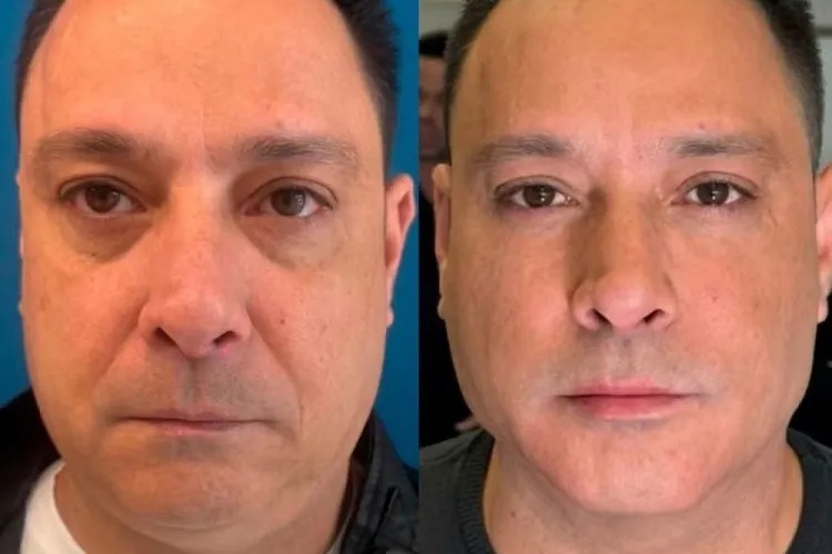 Antes e depois do Márcio (Foto: Reprodução)