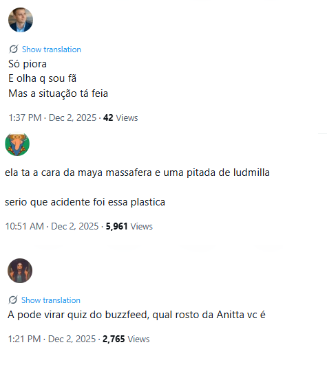 Internautas comentam mudança de aparência de Anitta (Foto: X)