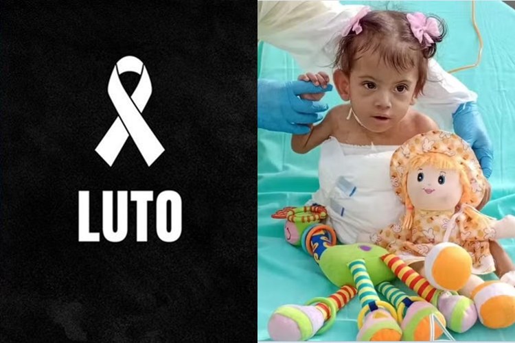 Morre Aruna Rodrigues, bebê siamesa que se separou da irmã, na véspera de Natal