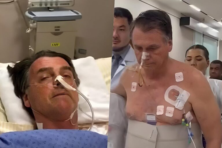 Jair Bolsonaro passará por endoscopia nesta quarta-feira (31/12)