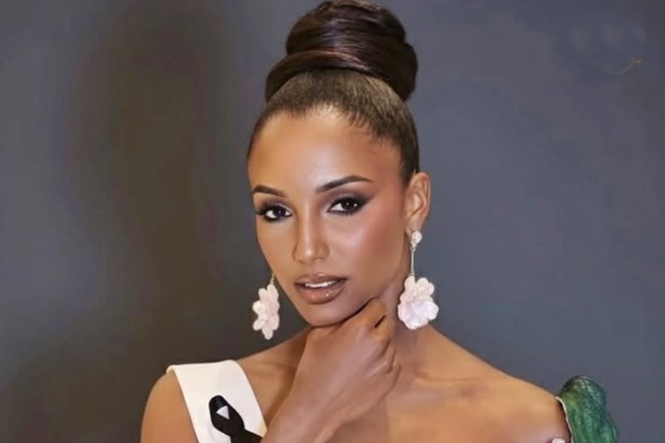 Miss Gabrielle Henry sofre acidente, é internada às pressas e grave diagnóstico é confirmado