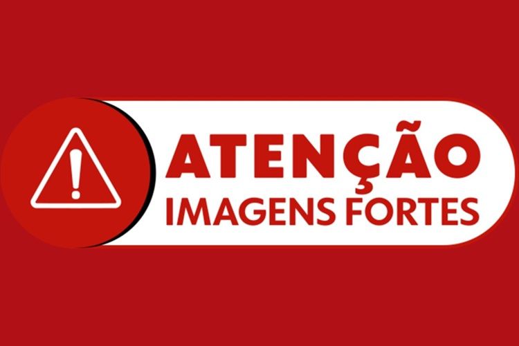 Aviso de Imagens fortes (Foto: Reprodução/ G1) Aviso de Imagens fortes (Foto: Reprodução/ G1) Nitrogênio