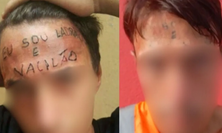 “Ladrão e vacilão”: jovem que teve testa tatuada é preso após roubar UBS