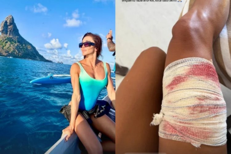Turista é mordida por tubarão durante mergulho em Fernando de Noronha