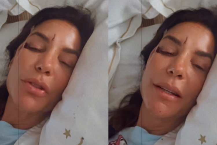 Famosos amparam Ivete Sangalo após acidente: “Vai ficar tudo bem!”