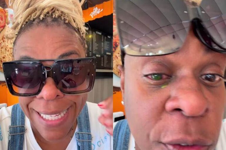 Após uso de produto capilar, Cacau Protásio tem reação alérgica grave nos olhos